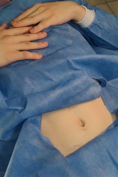 cute belly button|belly button removed surgically.